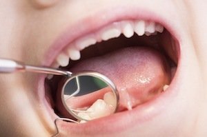 Запись к детскому стоматологу