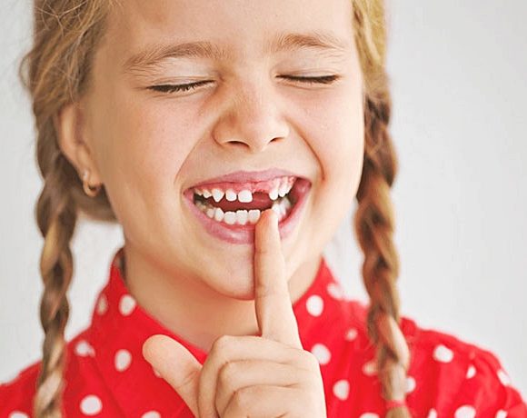 Что Вы должны знать о травмах зубов?