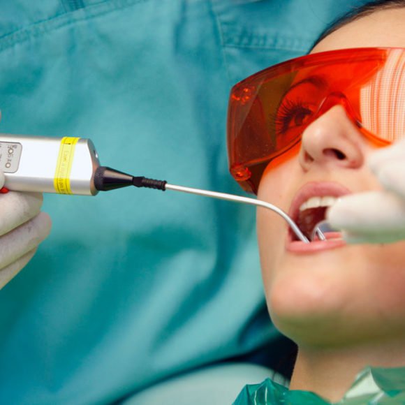 Лечение зубов с помощью лазера
